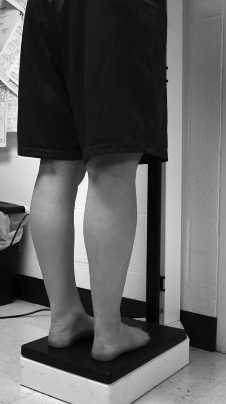 Manipals Biggest Loser - Weighing up Weighing up